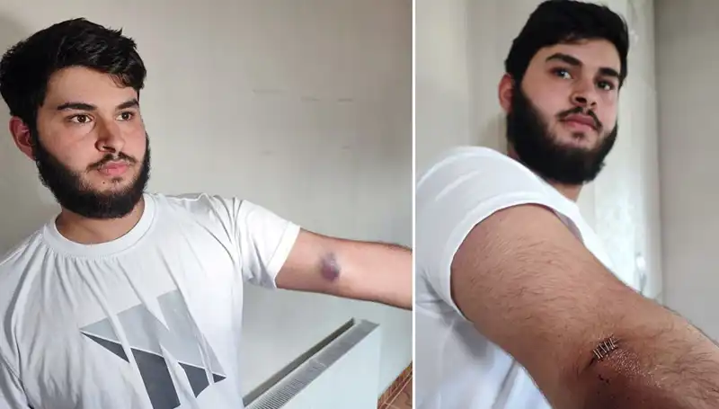 Bahçeye Kaçan Top, Mahallede Kargaşaya Neden Oldu
